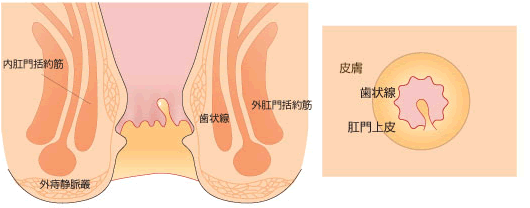 肛門ポリープ"