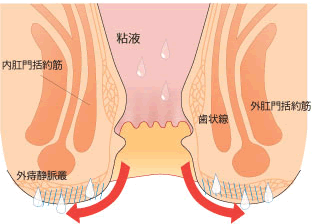 肛門周囲皮膚炎(肛門周囲掻痒症)"