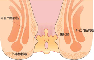 裂肛(れっこう)